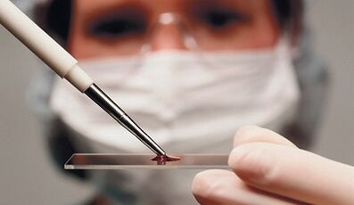 Differentialdiagnose von Attributen und Arthrose